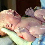Birth Injury Defects